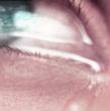 pleure
